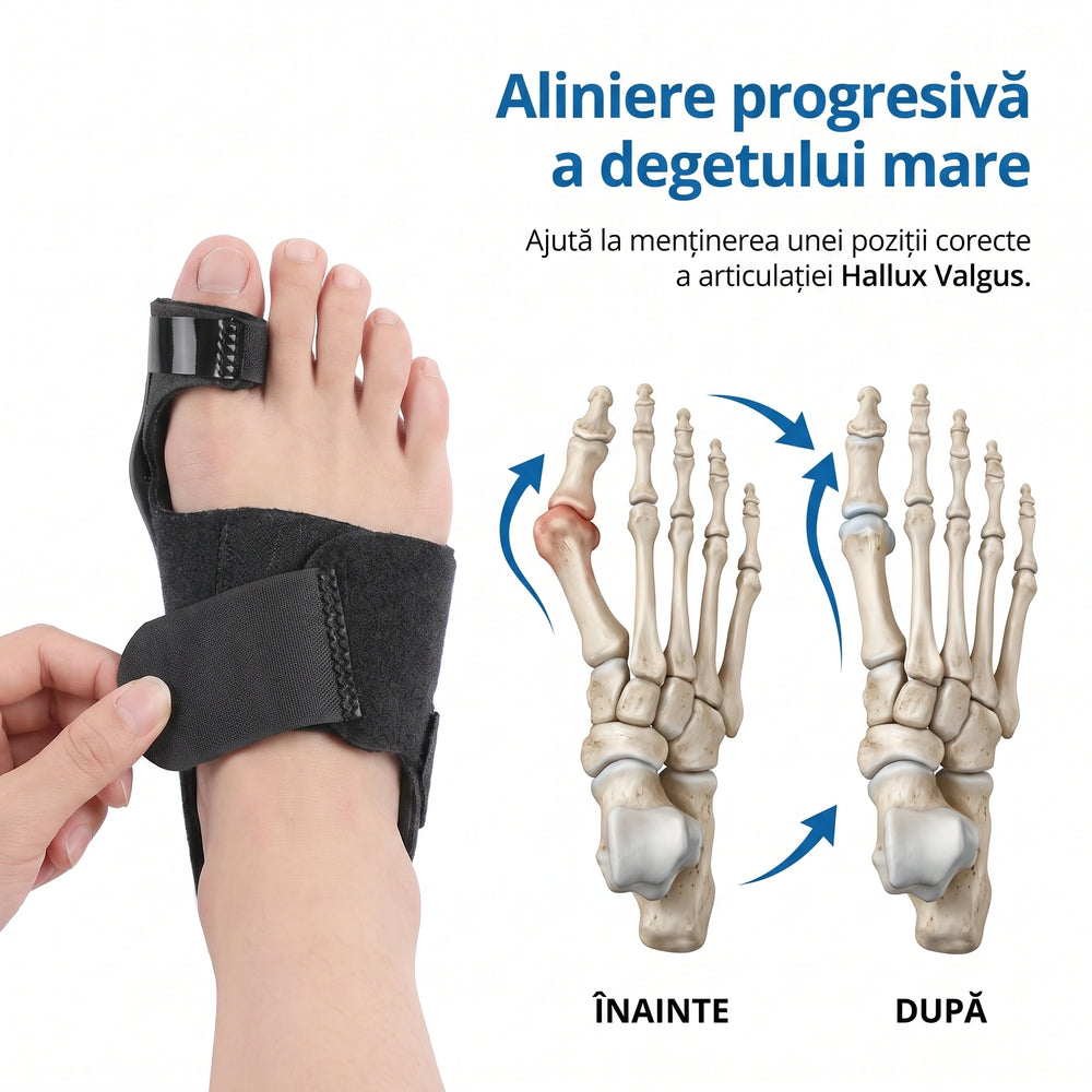 Corectorul de monturi reglabil cu bretea flexibilă