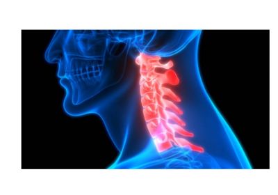 Spondiloza cervicala, o afectiune a coloanei vertebrale tot mai des intalnita