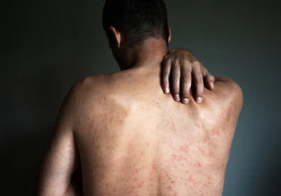 5 sfaturi de protectie a pielii daca iti petreci prea mult timp in pat