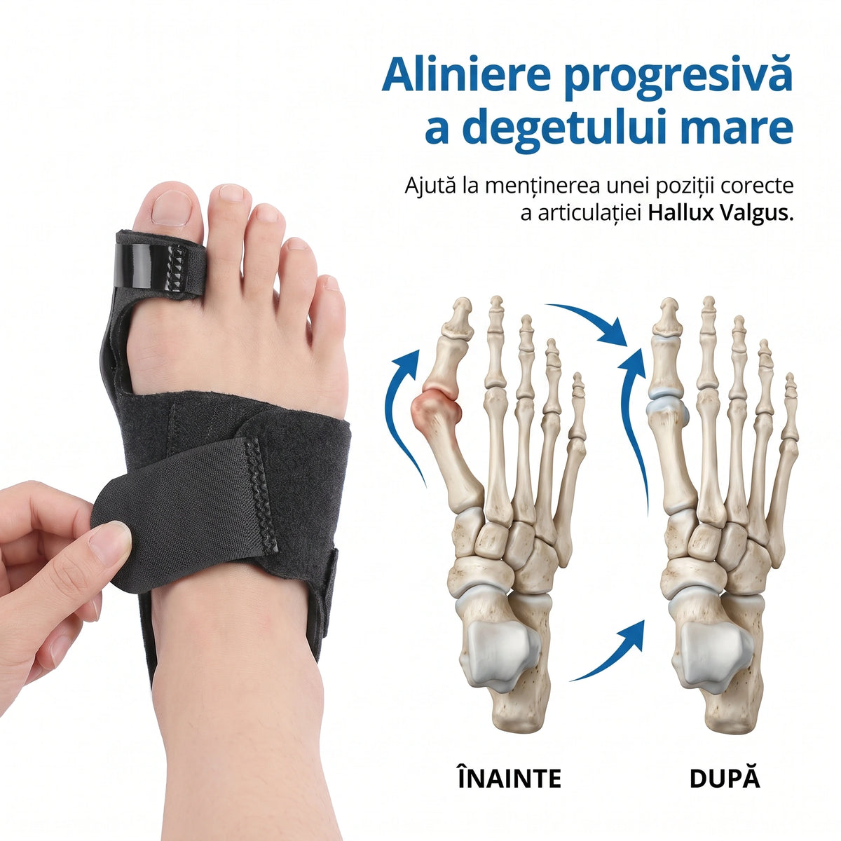Corector monturi (Hallux Valgus) cu bretea flexibila, reglabil, picior drept – imaginea 2