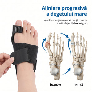 Corector monturi (Hallux Valgus) cu bretea flexibila, reglabil, picior drept – imaginea 2