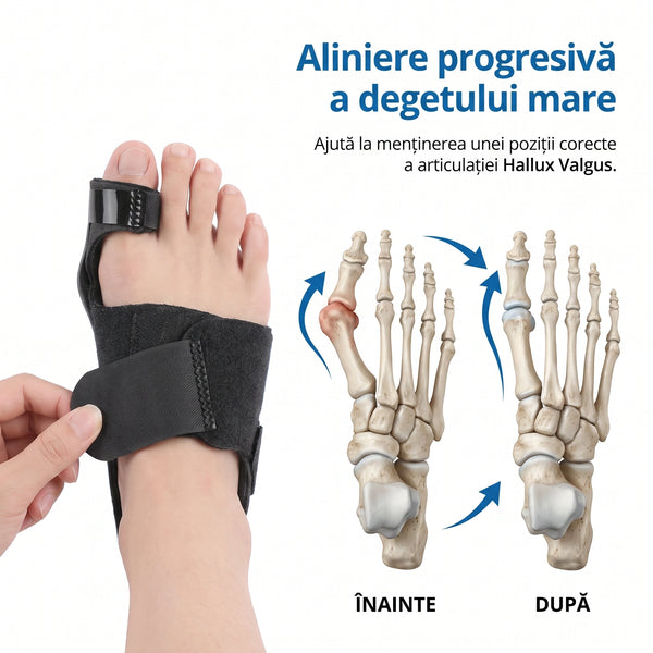 Corector monturi (Hallux Valgus) cu bretea flexibila, reglabil, picior drept – imaginea 2
