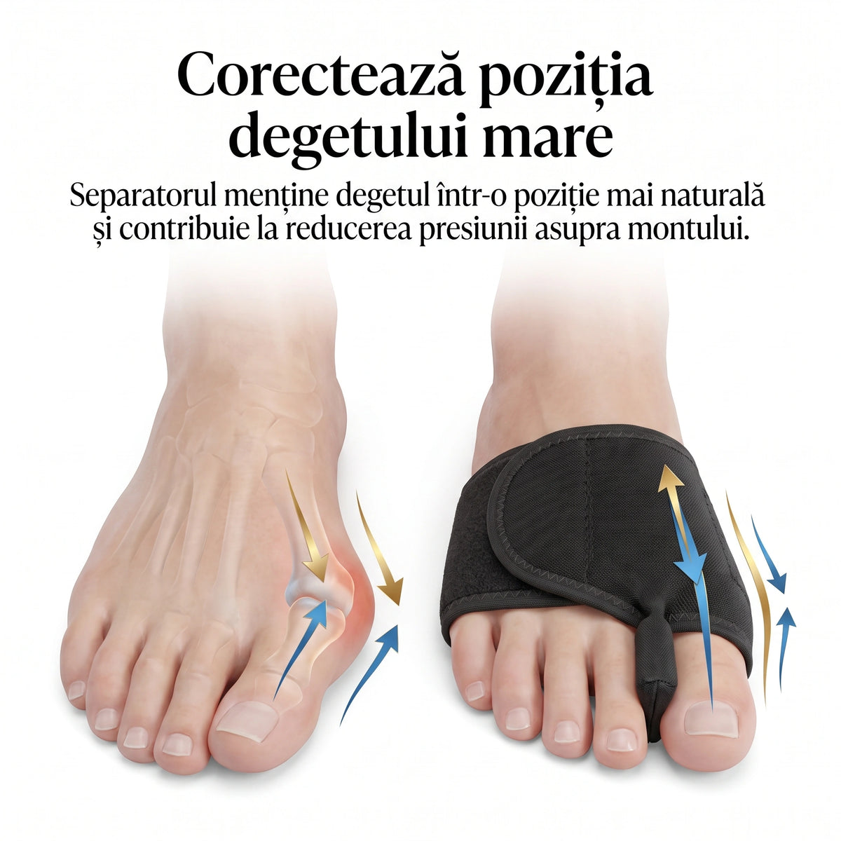 Corector monturi (separator degete) din poliester, reglabil, 2 buc, Negru – imaginea 2